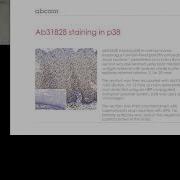 Immunohistochemistry Protocol Optimization And Troubleshooting Tips Final