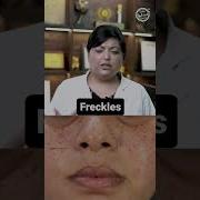 How To Get Rid Of Freckles Freckles Skincare Shorts DMC Drniveditadadu
