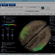 Quantitative EEG Demonstration