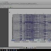 Part 4 Preprocessing EEG Data With Eegfix
