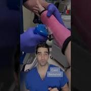 Orthopedic Surgeon Discusses Fiber Glass Cast Removal For A Broken Wrist