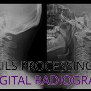 Details Processing In Digital Radiography