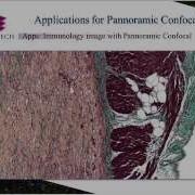3DHISTECH Digital Pathology On The Move Pannoramic Confocal