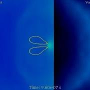 Shock Induced Bubble Implosion In Shockwave Lithotripsy Elastic 0 1 0 05