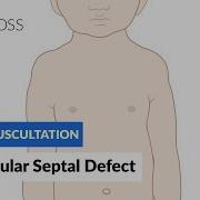 Ventricular Septal Defect VSD Heart Auscultation Episode 11