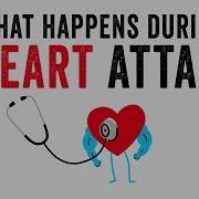 What Happens During A Heart Attack Krishna Sudhir