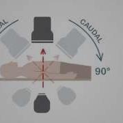 Mastering Coronary Angiography Image Intensifier C Arm Fundamentals