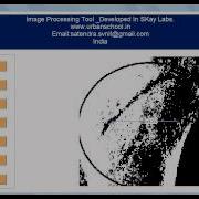 Image Processing Matlab GUI Bone Fracture Analysis