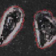 GVF Active Contours For Cell Segmentation