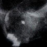 And That S One Million Particles 6 SPACE MADNESS