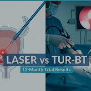 137 Ta Bladder Tumors In Office Laser Coagulation Compared To TUR BT