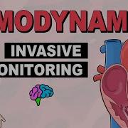Invasive Monitoring Hemodynamics Part 5