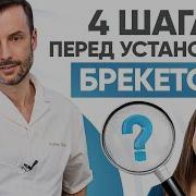 4 важных шага перед установкой брекетов Современная ортодонтия