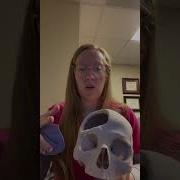 Hemicraniectomy A Life Saving Procedure To Remove Part Of The Skull To Relieve Brain Swelling
