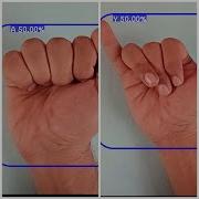 Real Time American Sign Language Detection In Android Using Python And Tensorflow Lite