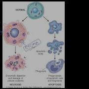 4 Introduction To Pathology Necrosis Vs Apoptosis