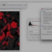 FIJI For Quantification Area Of Stain