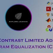Image Enhancement Contrast Limited Adaptive Histogram Equalization