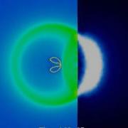 Shock Induced Bubble Implosion In Shockwave Lithotripsy Elastic 0 05 0 05
