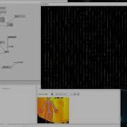 Vvvv Kinect