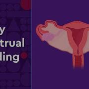 Heavy Menstrual Bleeding And Available Treatment For Teens