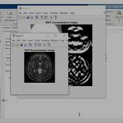 IMAGE COMPRESSION AND DECOMPRESSION USING STATIONARY WAVELET TRANSFORM
