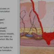 Wound Healing Process Flv