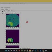 3D Unet Model For Brain Tumor Segmentation Brats Dataset Python