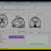 LORETA Time Domain Capture