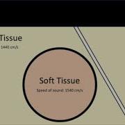 Edge Shadowing On Ultrasound