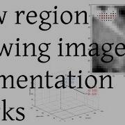How Region Growing Image Segmentation Works