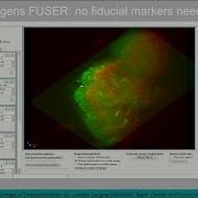 Huygens Deconvolution And Fusion Of Light Sheet Data Demo