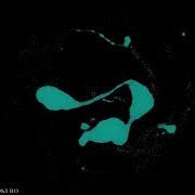 SST N Body Timelapse