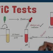 IMViC Tests Procedure And Principle Microbiology