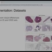 SC MIL Supervised Contrastive Multiple Instance Learning For Imbalanced Classification In Pathology