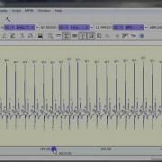 Automated ECG Analysis LEAD II