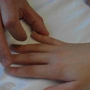 Test De Wartenberg