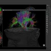 BrainMagix 2 1 Constrained Spherical Deconvolution Based Tractography