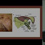 Review Of The Pathology And Congenital Anomalies Of The Coracoid Process Lexian J McBain MD