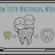 How Teeth Whitening Works
