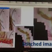 Microscope Image Stitching