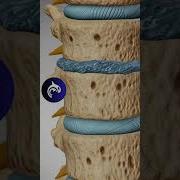 Degenerative Disc Disease 4K 3D Animation