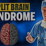 What Happens When The Two Halves Of Your Brain Can T Talk