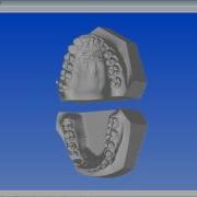 OrthotechOhio 3 D Digital Model Viewer