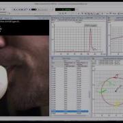 TEMA Motion Analysis Contour Tracker