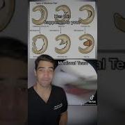 Orthopedic Surgeon Talks About Different Types Of Meniscus Tears And How To Fix And Treat Them