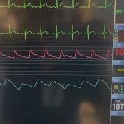 ICU Bedside Monitor Tutorial