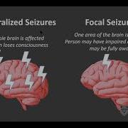 Ut Brainstorms The Stimulated Brain