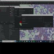 Cell Classification And Density Maps With QuPath