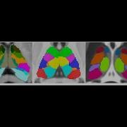 Thalamic Segmentation E Symposium Welcome Note